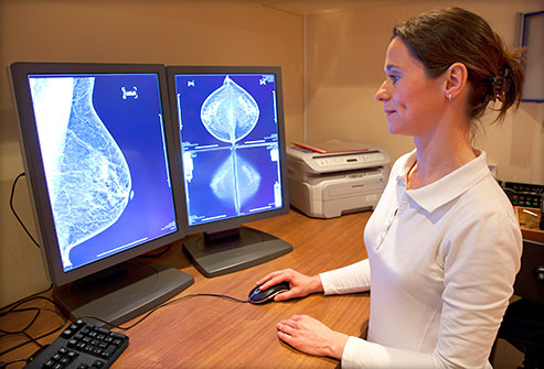 493x335_advanced_breast_cancer_treatments